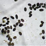 Stachybotrys Chartarum Toxic Black Mold